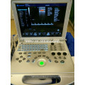 Ultra-sonografia abdominal de doppler da cor 3D betterh do ultra-som do sonoscape